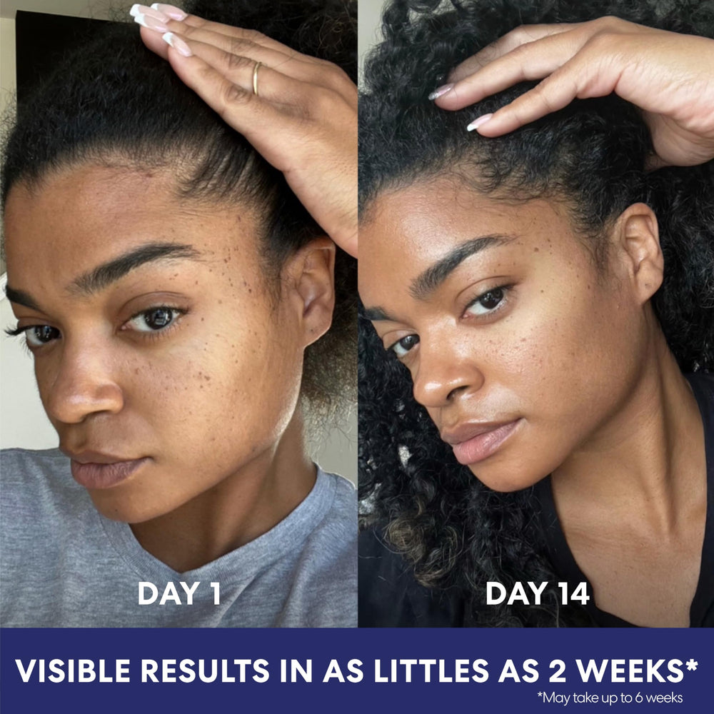 Palmer's with 5% niacinamide for brightness support.