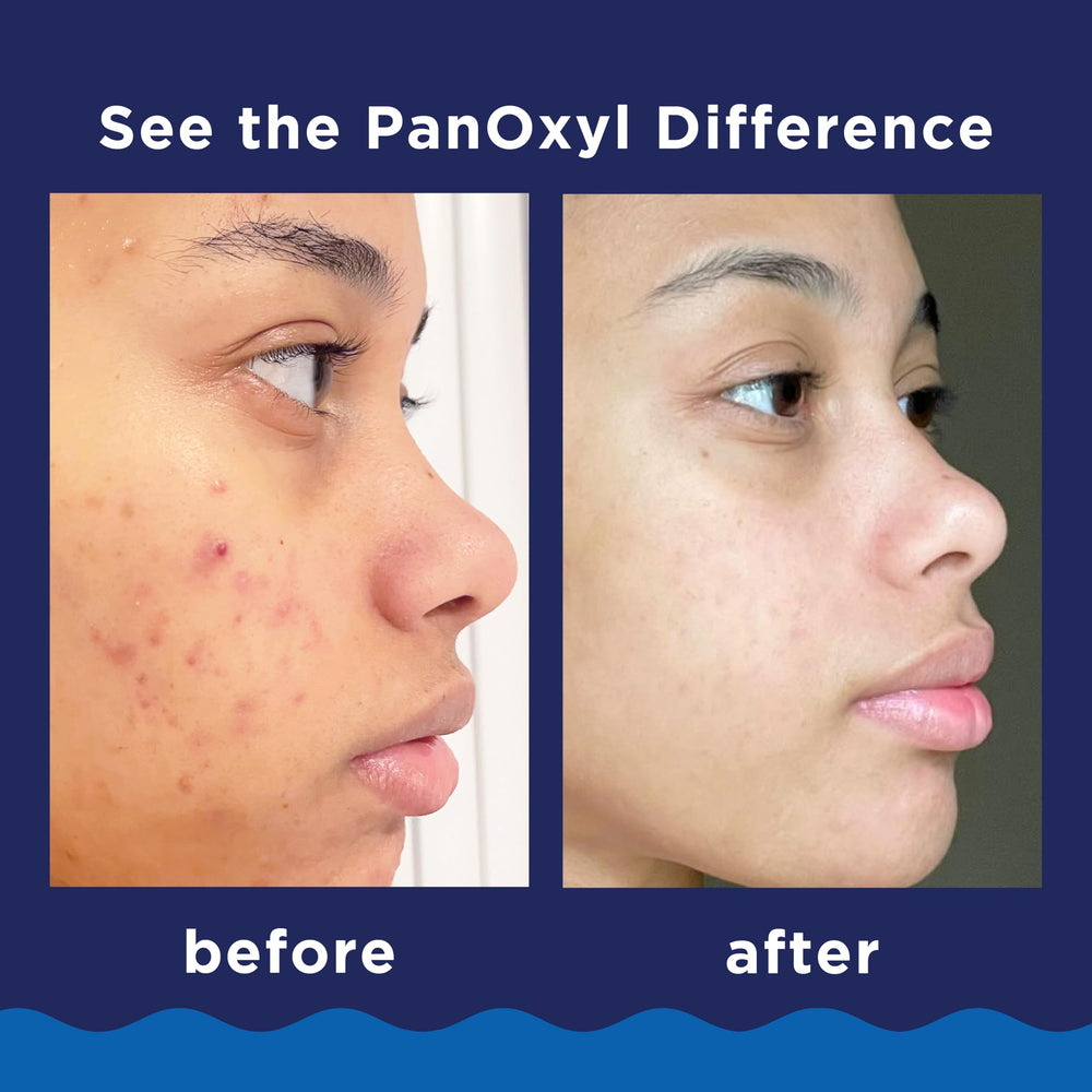 PanOxyl facial and body cleanser packaging emphasizing convenience for on-the-go skincare.