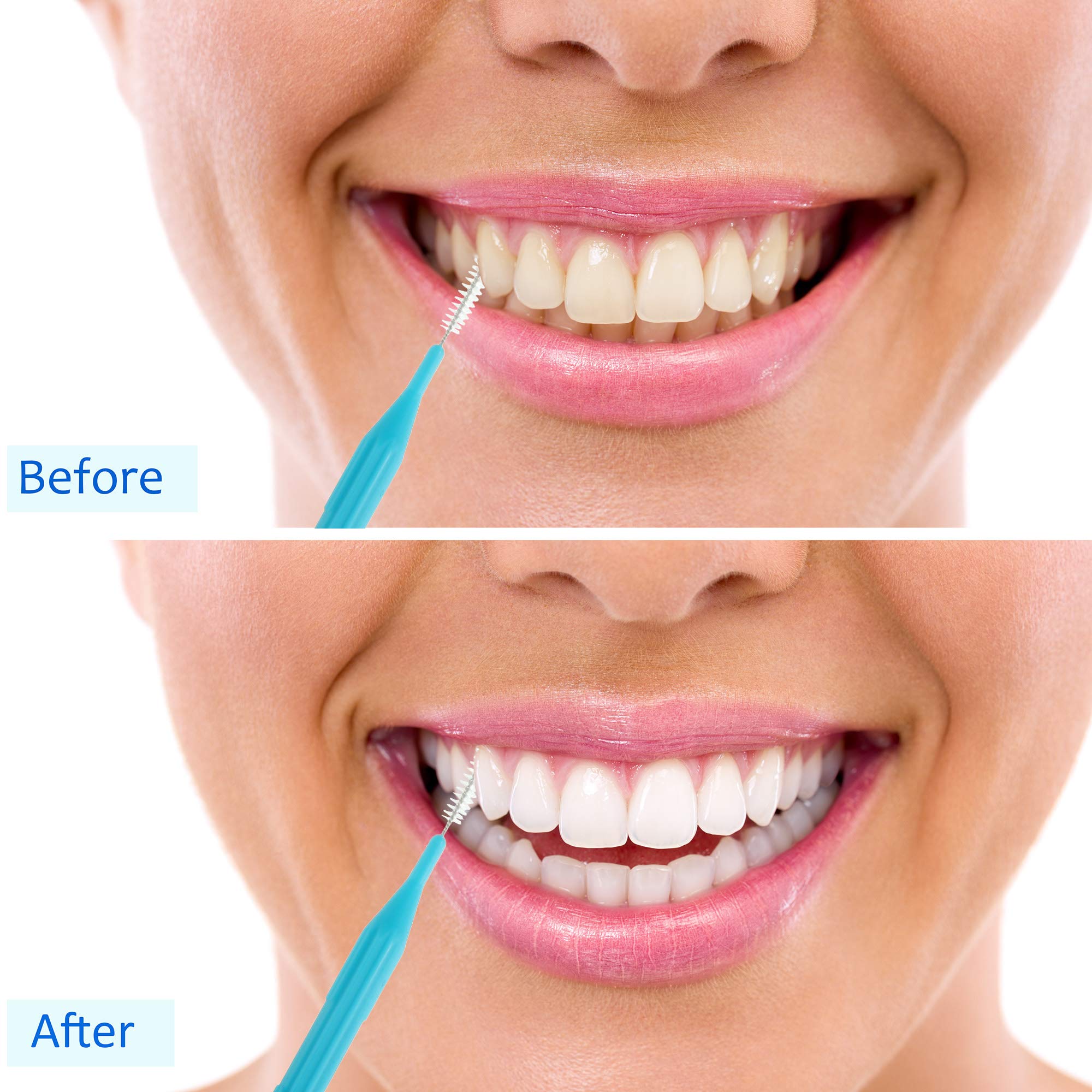 Patelai precision brushes target spaces near crowns and bridges.