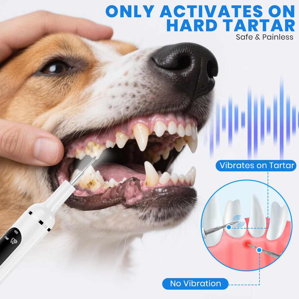 PATWING plaque remover offers five modes for flexible at-home cleaning