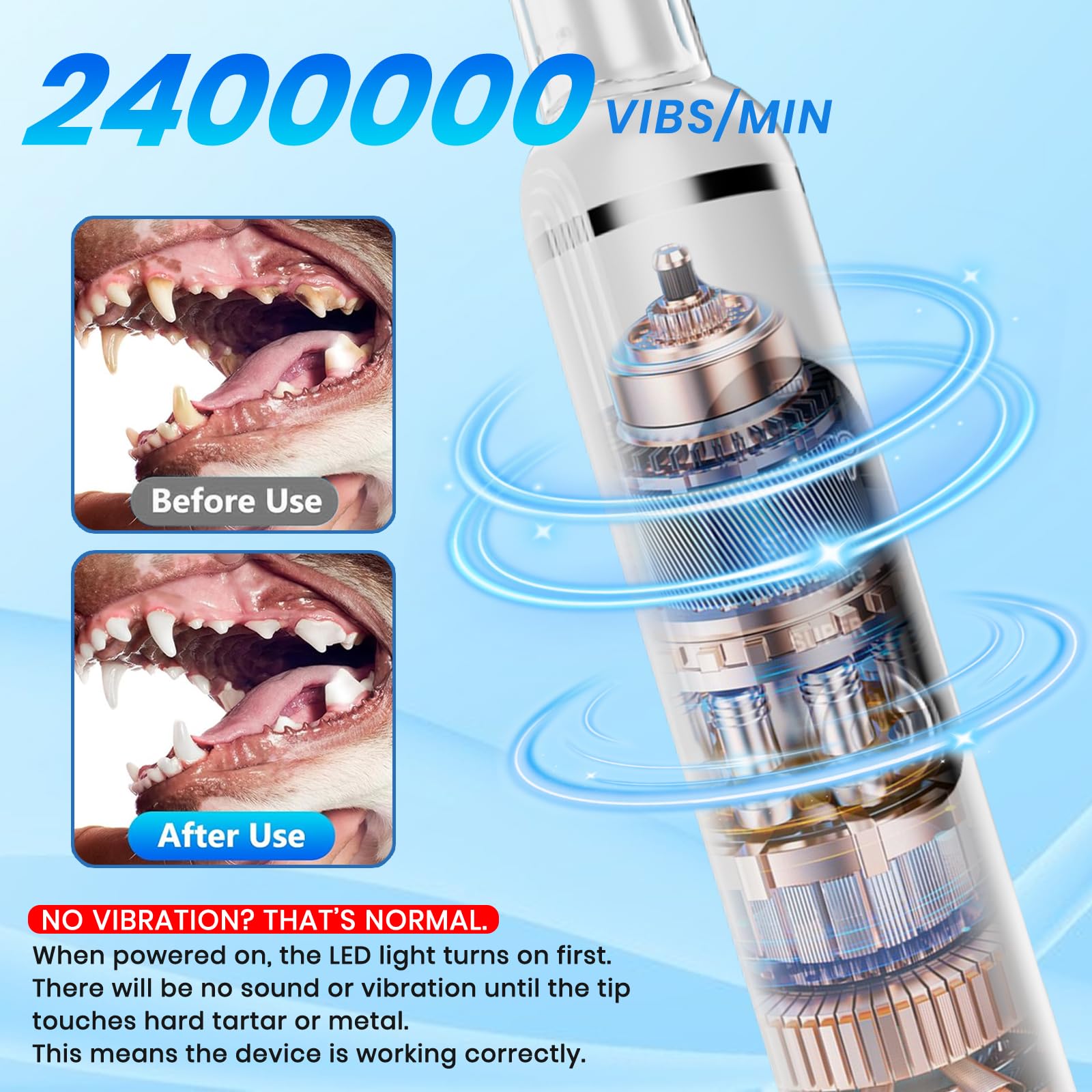PATWING ultrasonic action targets hard tartar while protecting gums