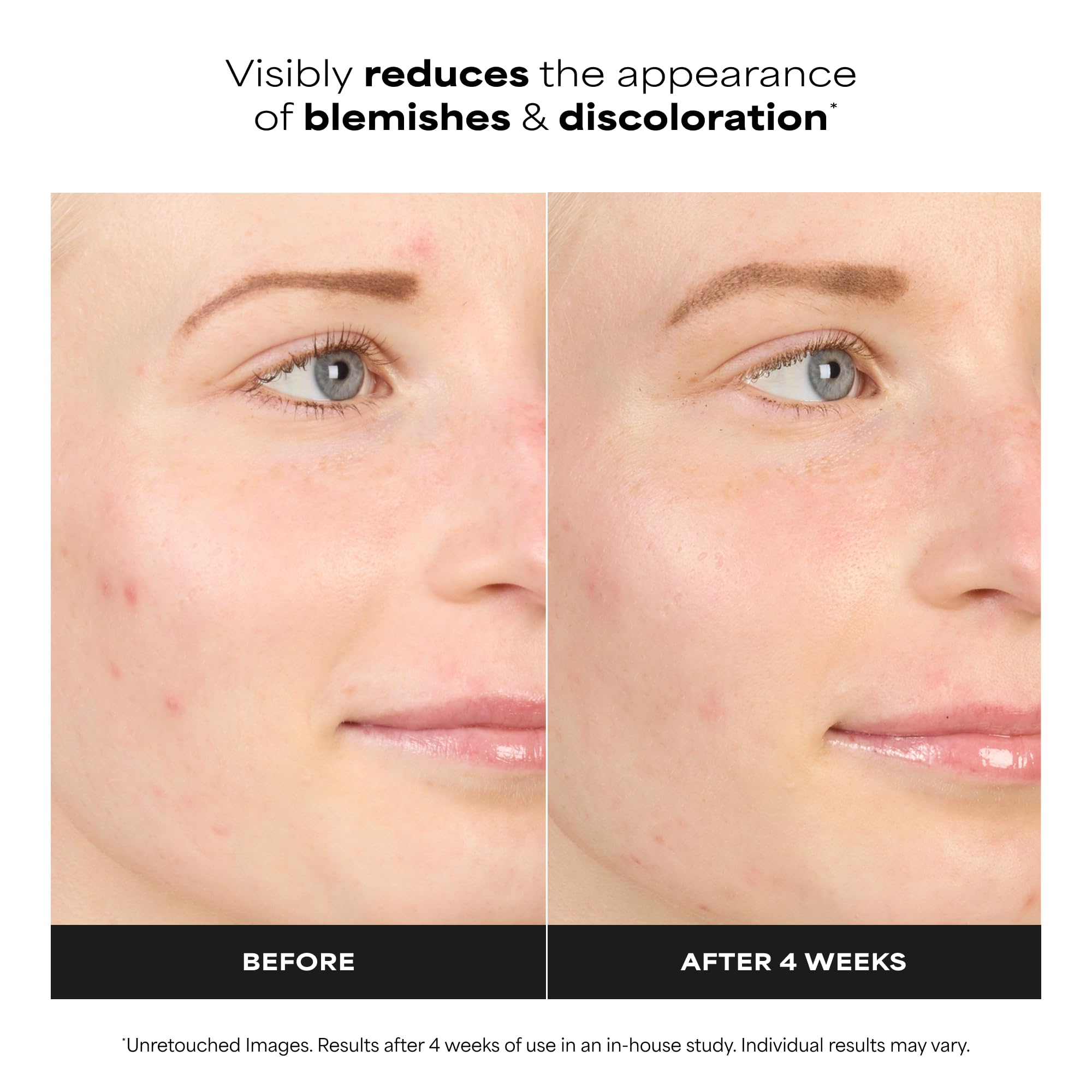Dropper dispense of Paula's Choice 10% Azelaic Acid Booster demonstrates easy, precise application