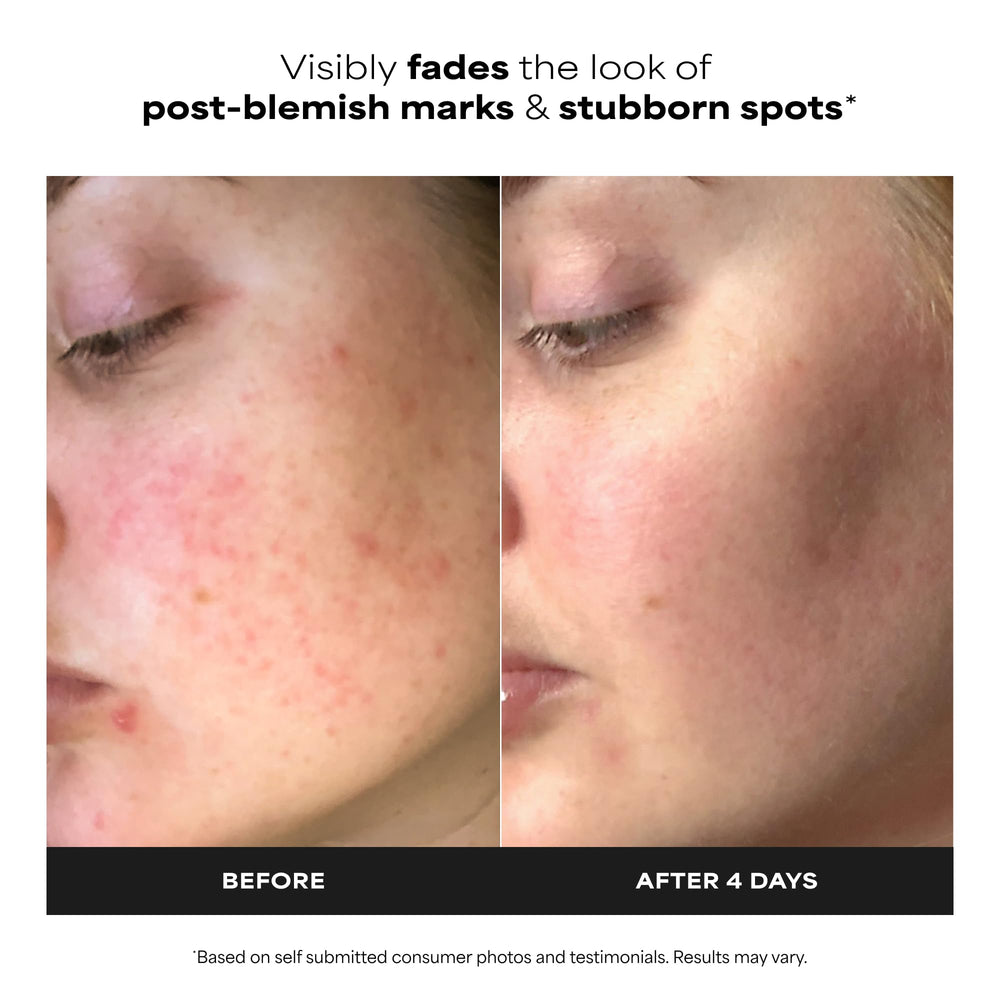 Paula's Choice BOOST ingredients label highlights licorice and salicylic acid for gentle exfoliation.