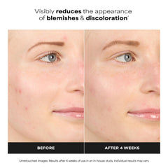 Paula's Choice BOOST travel-size packaging on vanity for easy travel skincare.