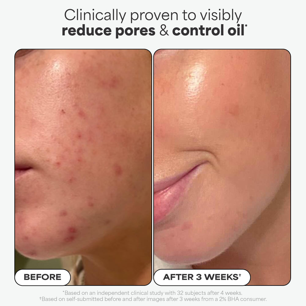 Fragrance-free label on Paula's Choice exfoliant indicating skin-friendly formula.