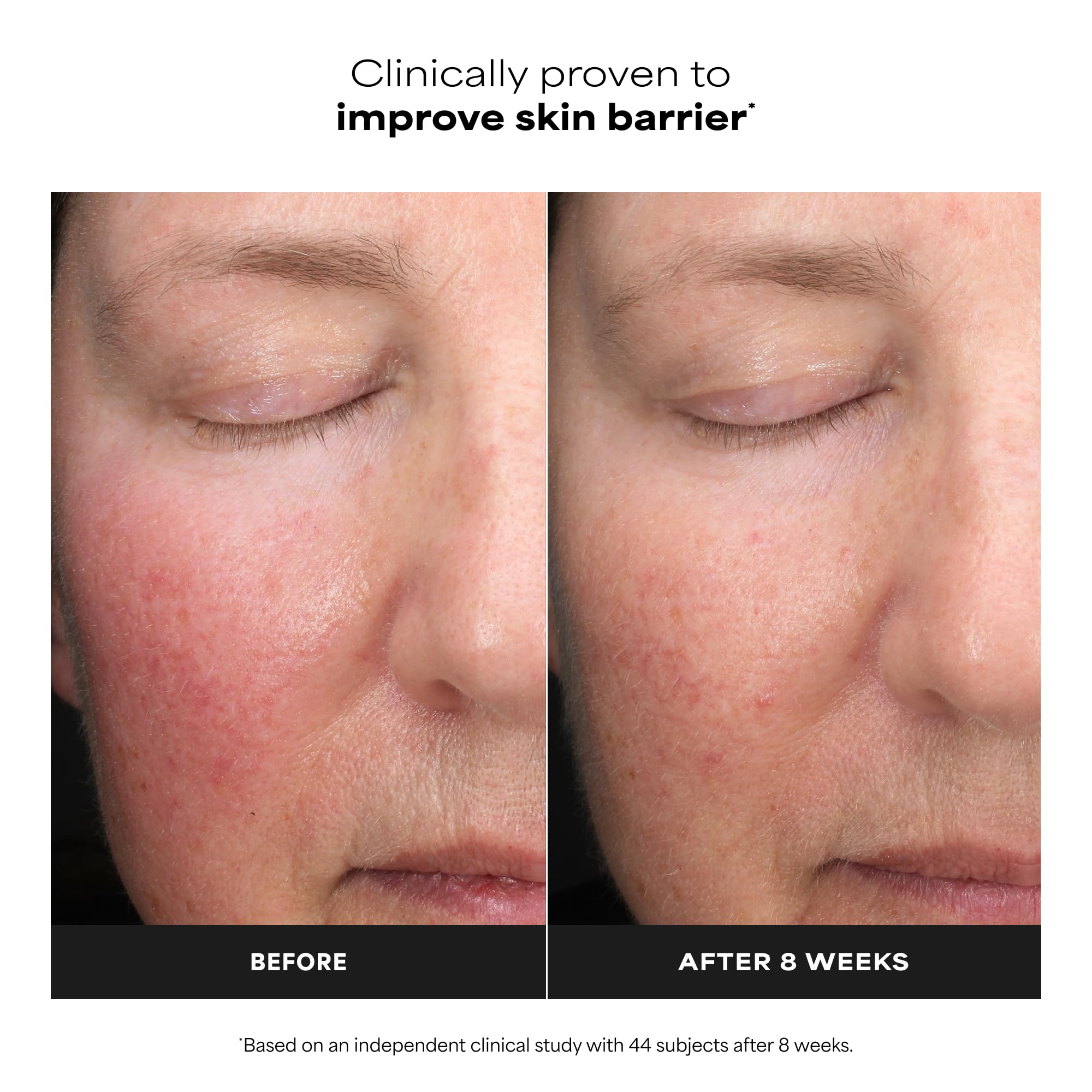 Graphic illustrating time-released lactic acid for gentle resurfacing