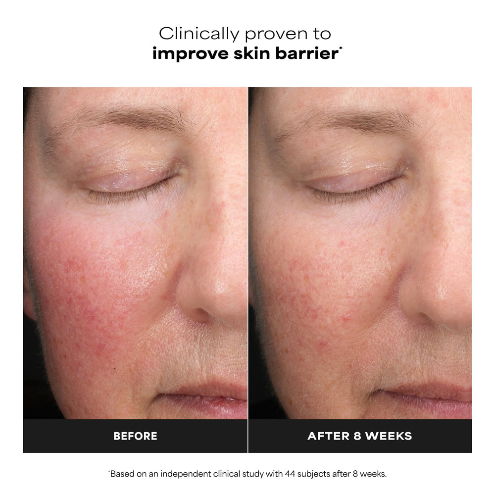 Graphic illustrating time-released lactic acid for gentle resurfacing