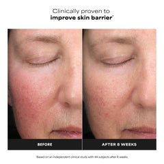 Graphic illustrating time-released lactic acid for gentle resurfacing