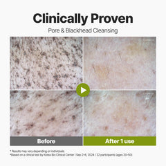 P.CALM mask exfoliates gently and controls surface oil for refreshed skin