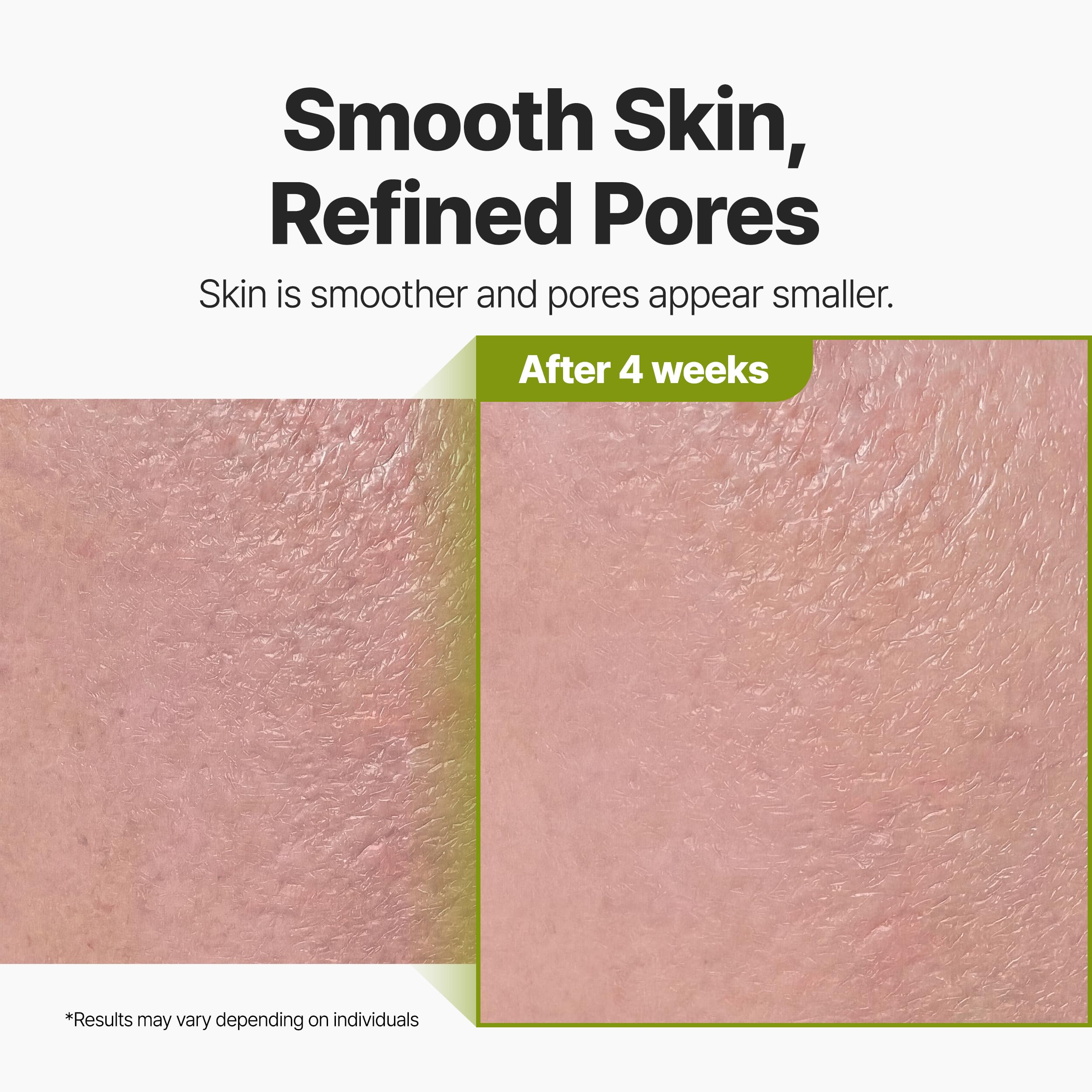 P.CALM Bubble Deep Mask provides spa-like experience at home