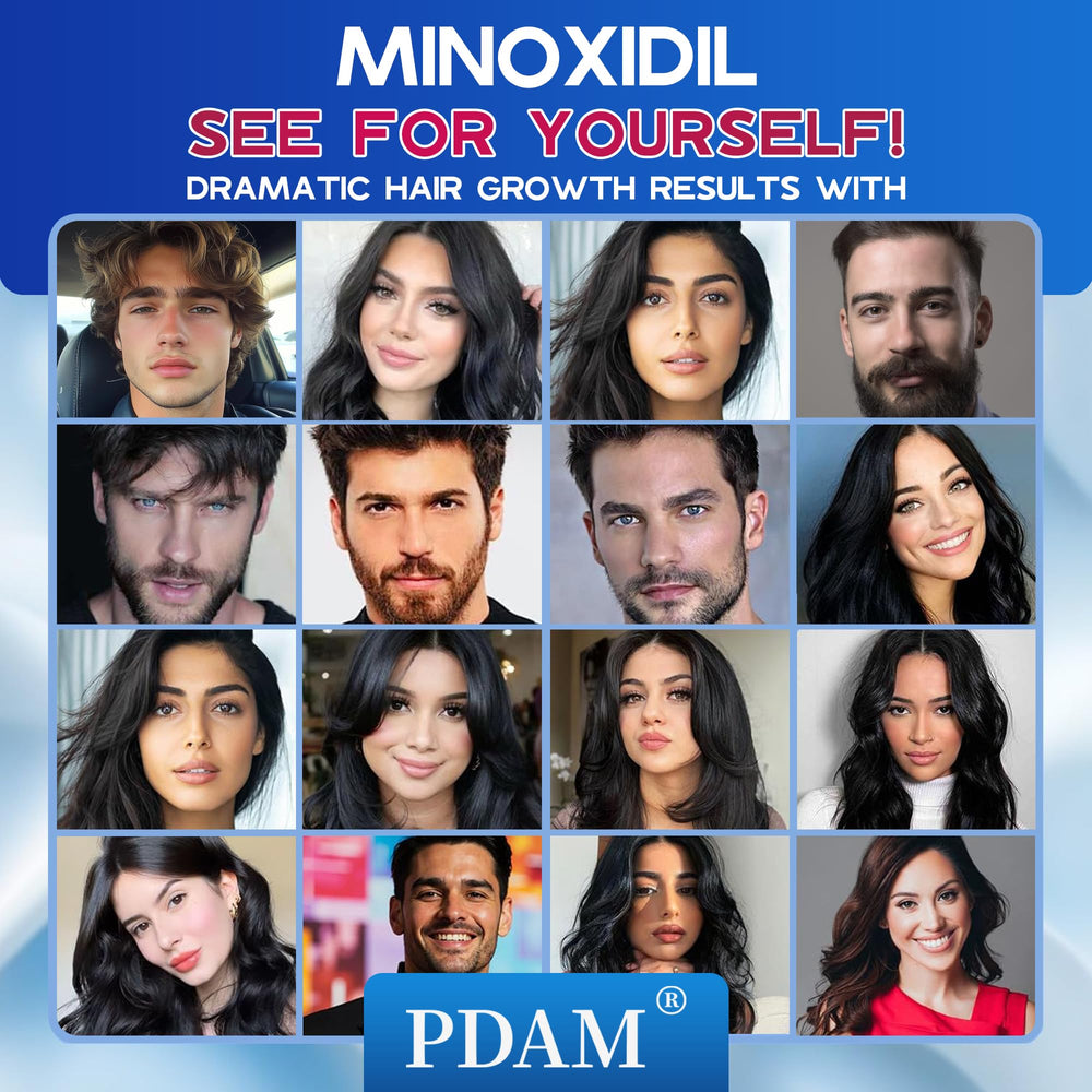 Pdam Minoxidil foam on store shelf display