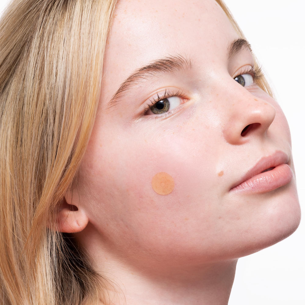 Peace Out Acne Healing Dots vegan, clean ingredients for skin-friendly blemish support