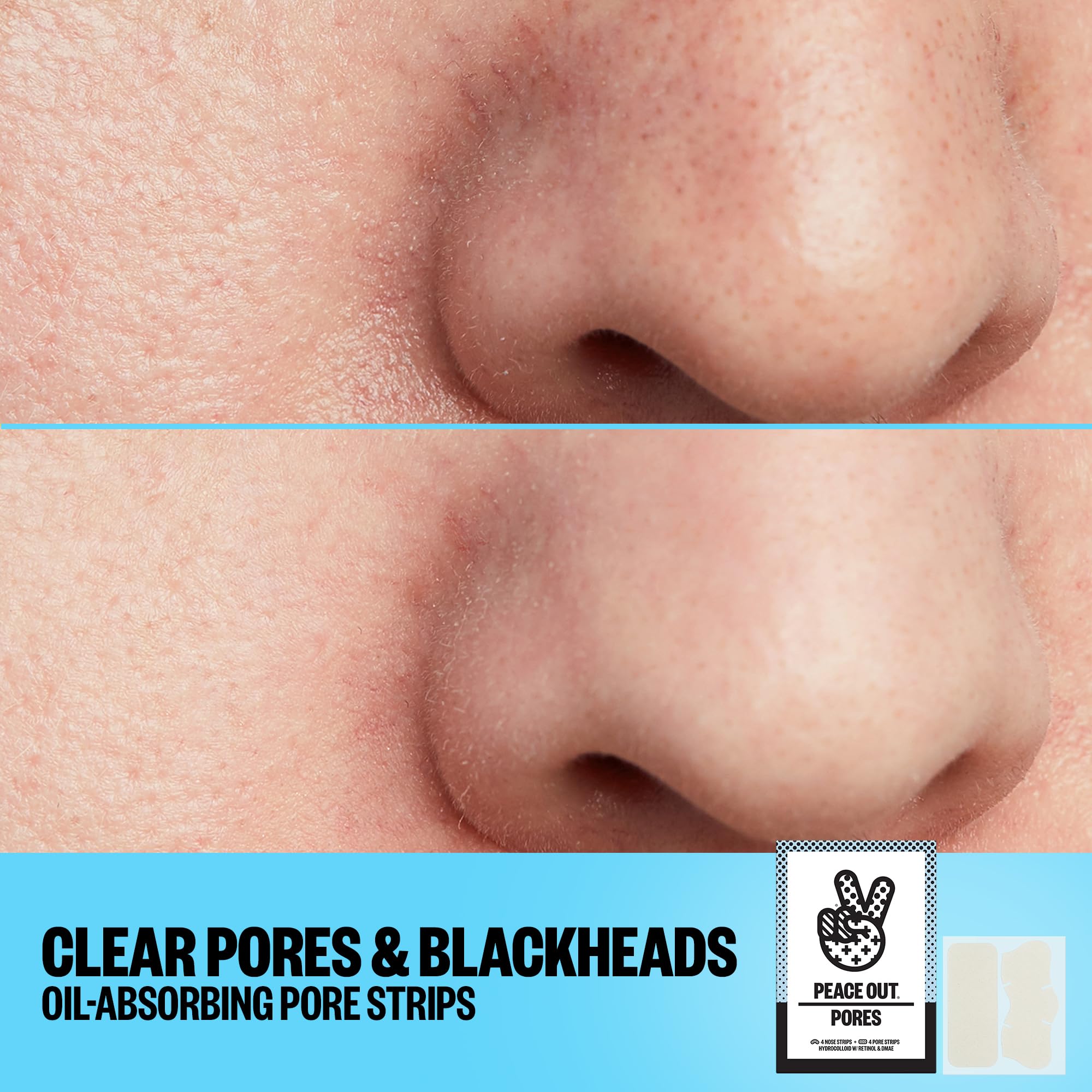 PEACE OUT Pore Strips a visibly clearer appearance after use