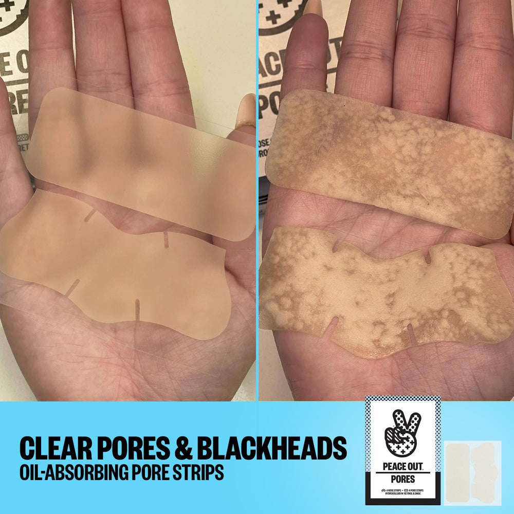 PEACE OUT Pore Strips packaging inside shows convenient 8-count box