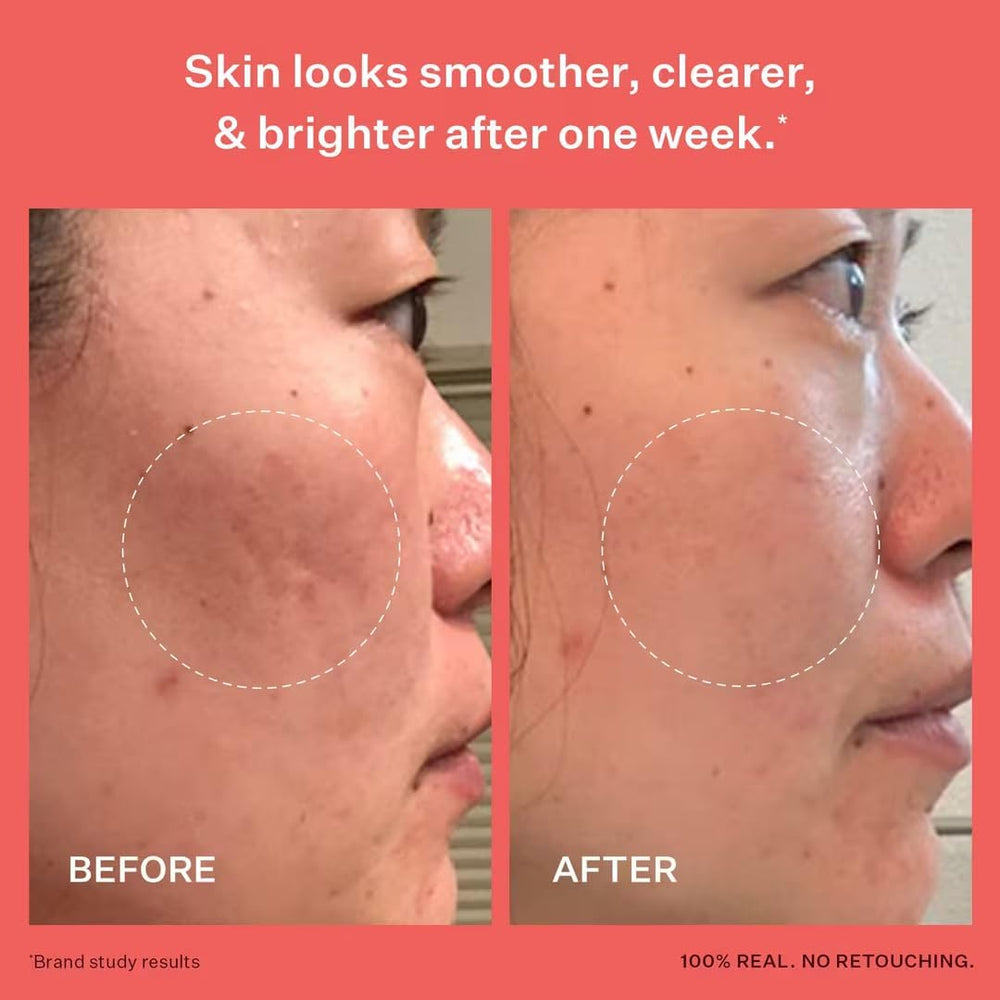 Peach & Lily hyaluronic acid texture close-up highlighting plump, smooth-looking skin