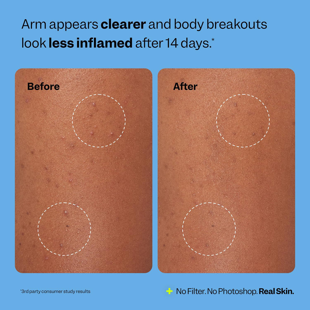 Cica-infused hydrocolloid highlights soothing formula