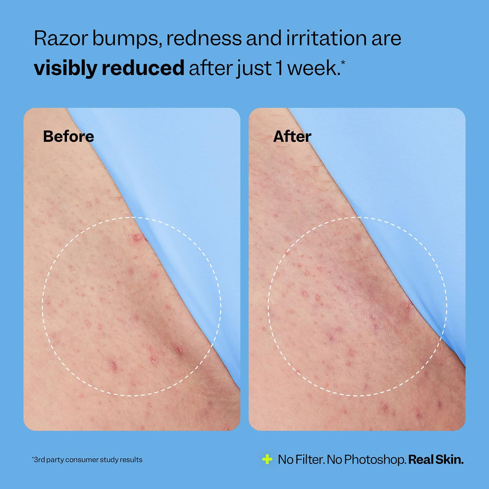 Peach Slices legs after shaving with hydrating actives.