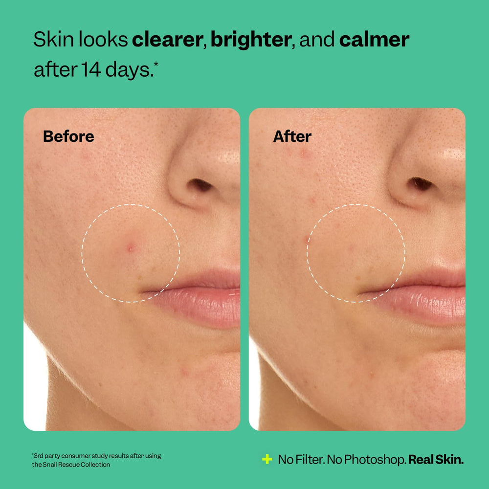 Peach Slices Snail Rescue Cleanser with pine bark supports refreshed pores