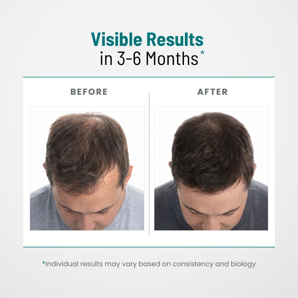 Peak Vitals DHT Blocker lab testing results signifying potency and purity.
