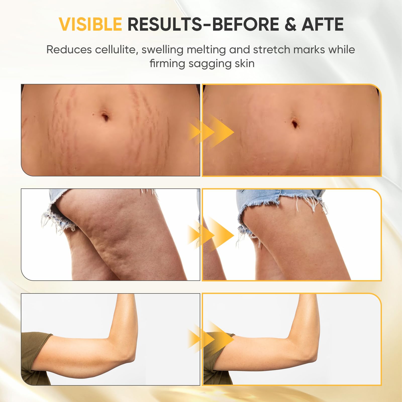 PEMUCEN Lymphatic Drainage Massager used on arms, legs, and belly for full-body use