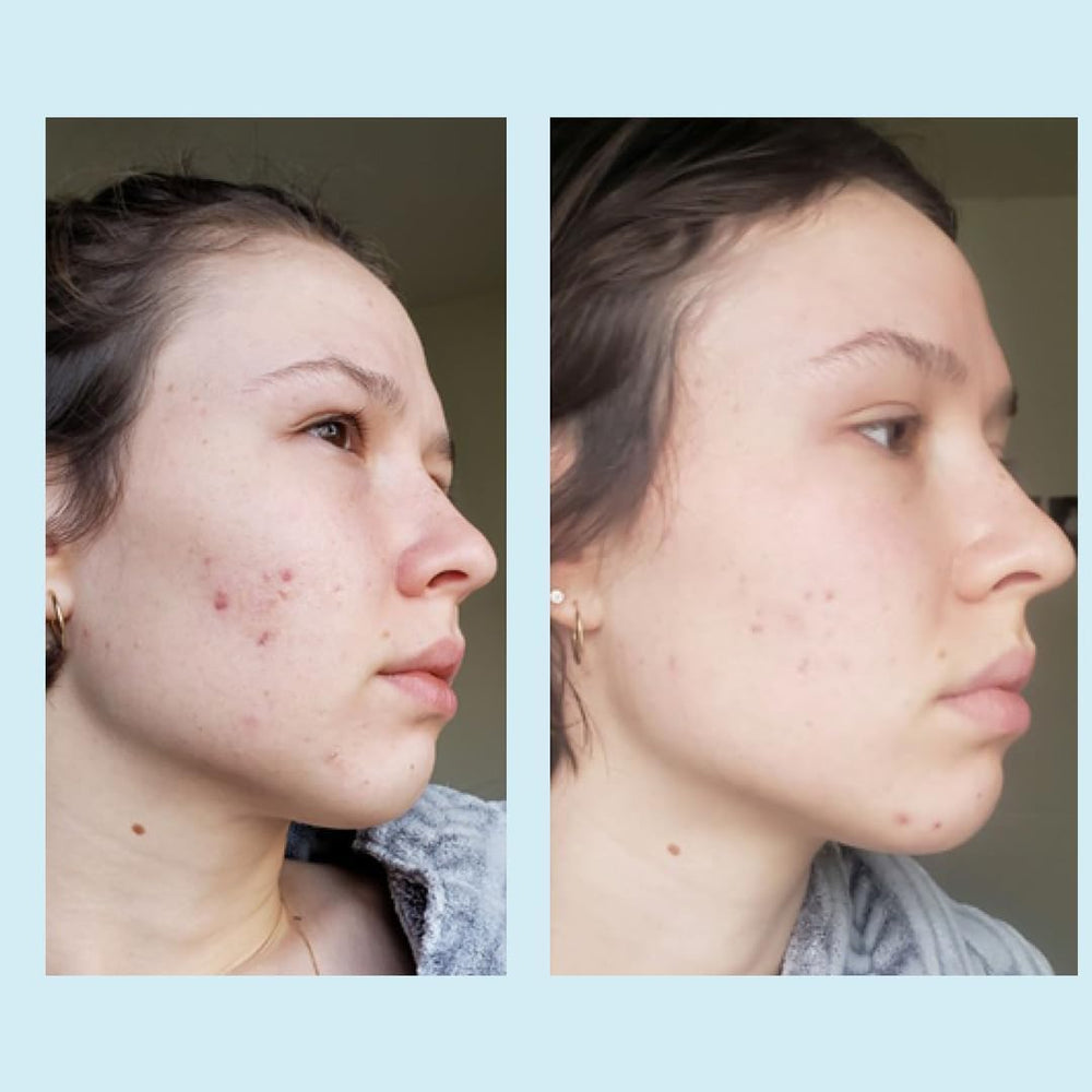 Application sequence illustration suggests a safe exfoliation routine.