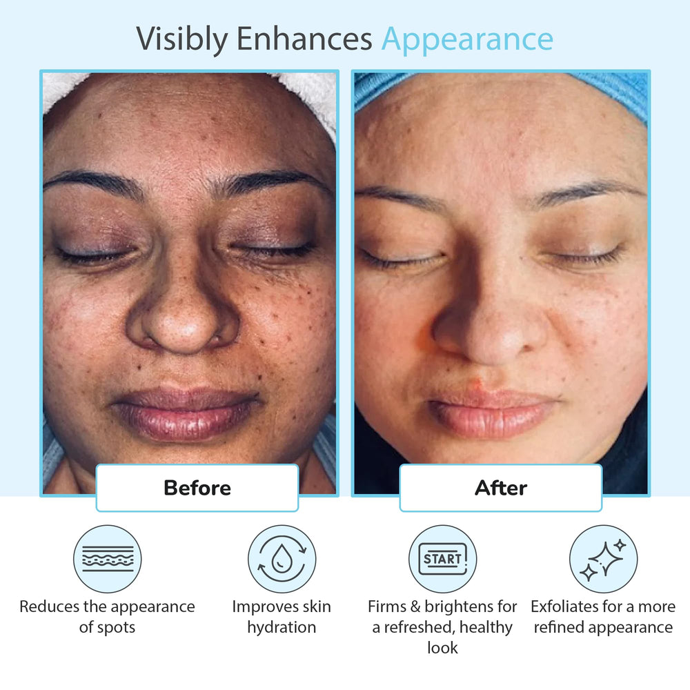 Close-up of skin after use hints at smooth refined surface.