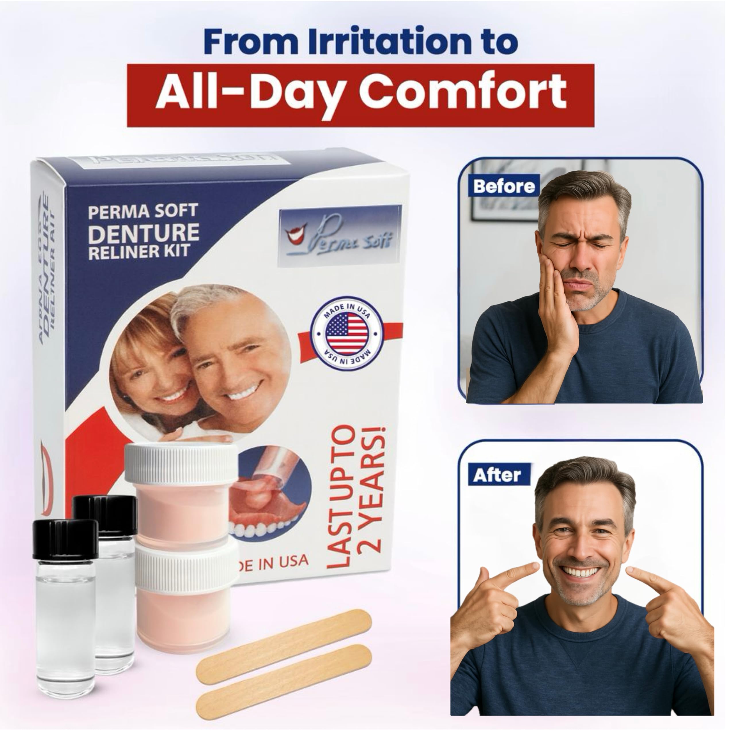 Perma Soft reliner application on dentures forming a secure cushion