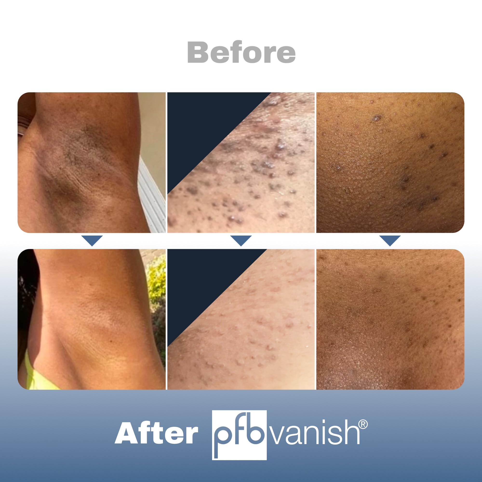 Person applying on skin demonstrating gentle, targeted treatment for inflamed areas.