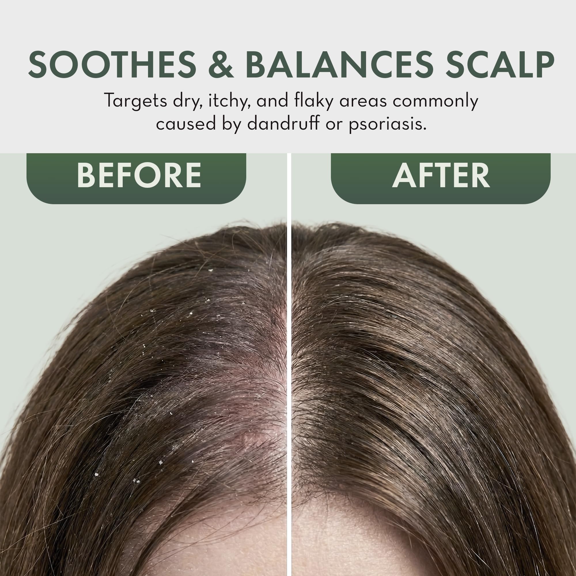 PHARM TO TABLE psoriasis-friendly scalp care with tea tree oil for comfort.