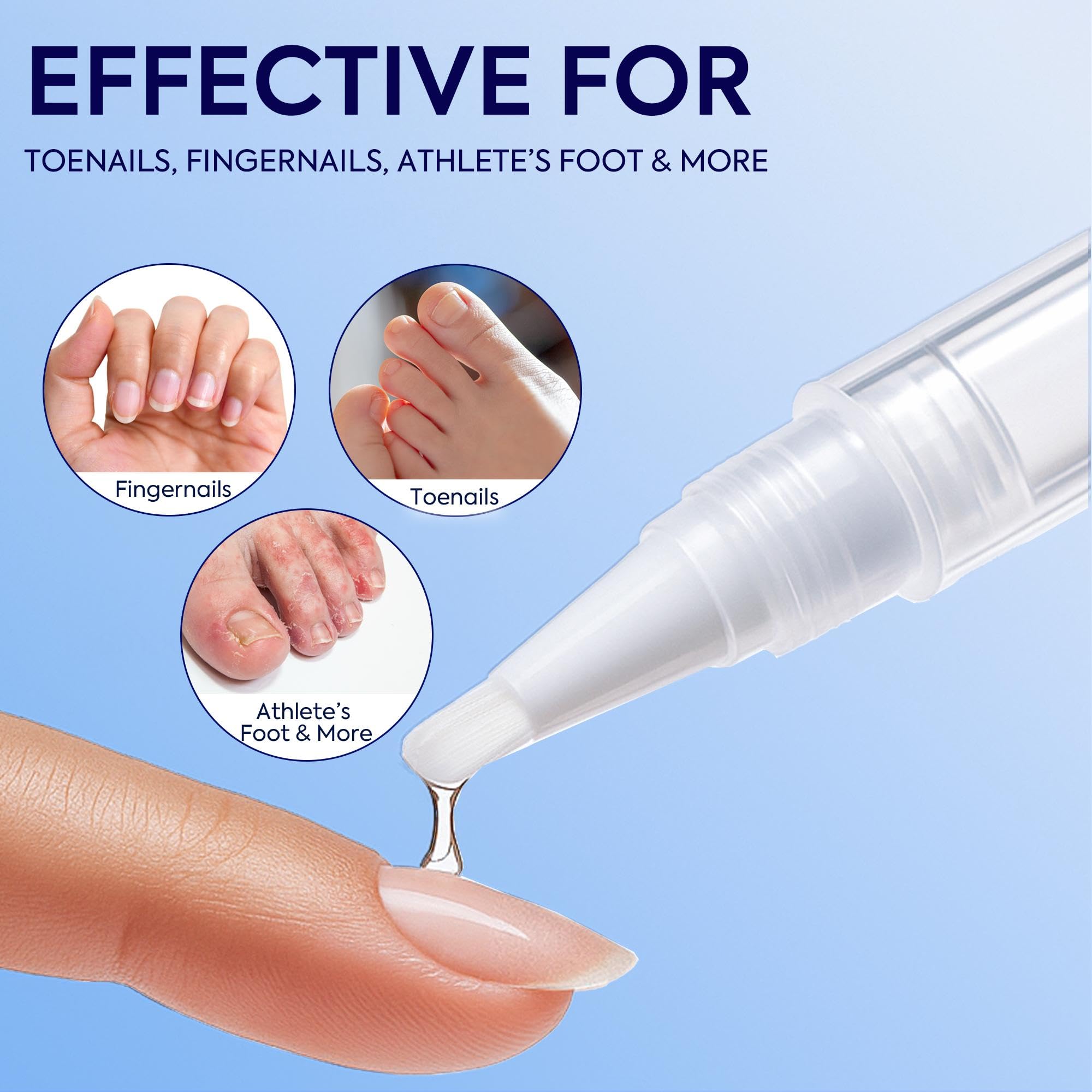 PHARMBANNER Discolored nails can look clearer with continued use.