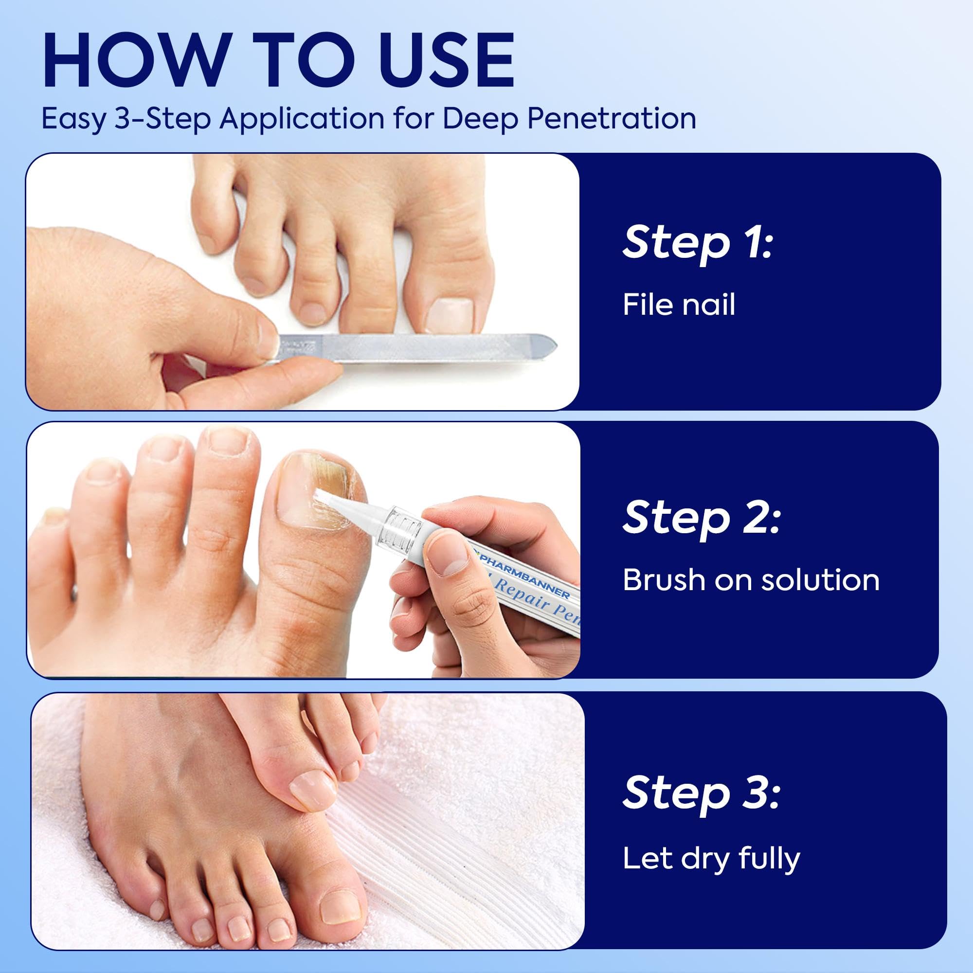 PHARMBANNER Pen used on an ingrown nail for targeted care.