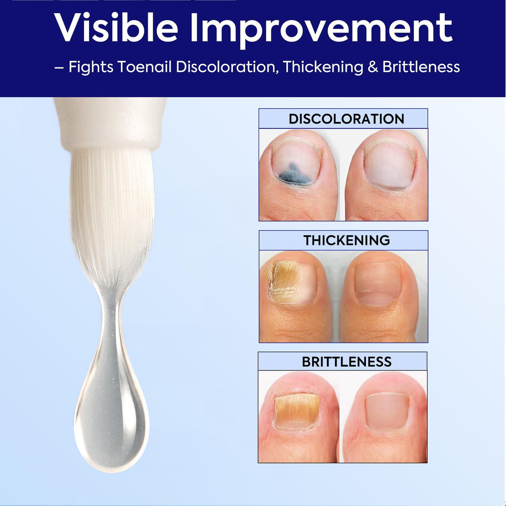 PHARMBANNER Nail File included to prep and smooth the nail surface.