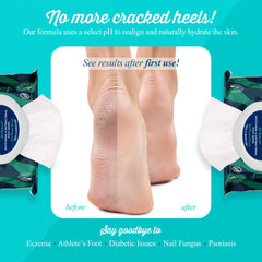 pHeet Foot Wipes essential oils scent boosts natural fragrance during use