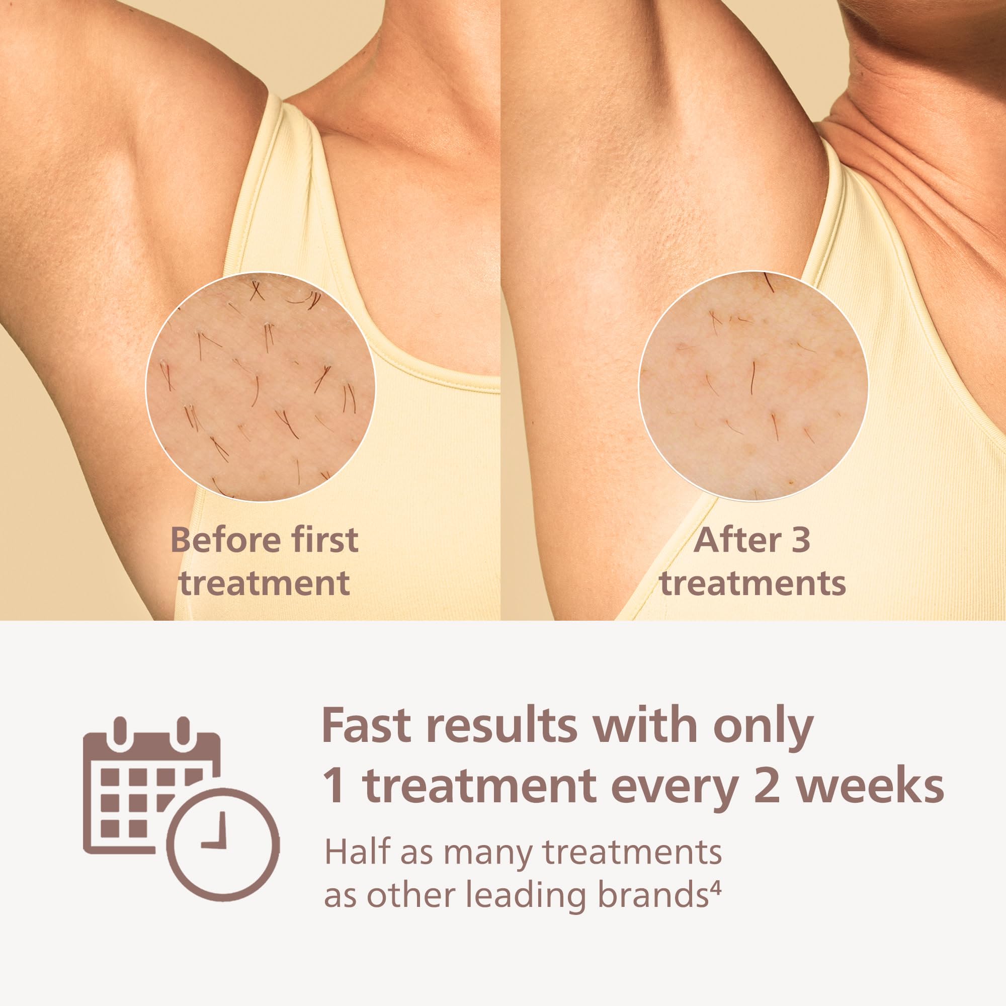 Philips Lumea 9000 underarms attachment for quick sessions