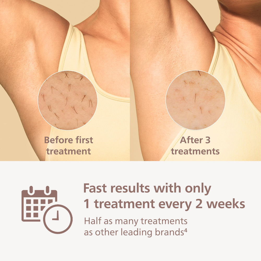 Philips Lumea 9000 underarms attachment for quick sessions