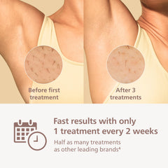Philips Lumea 9000 underarms attachment for quick sessions