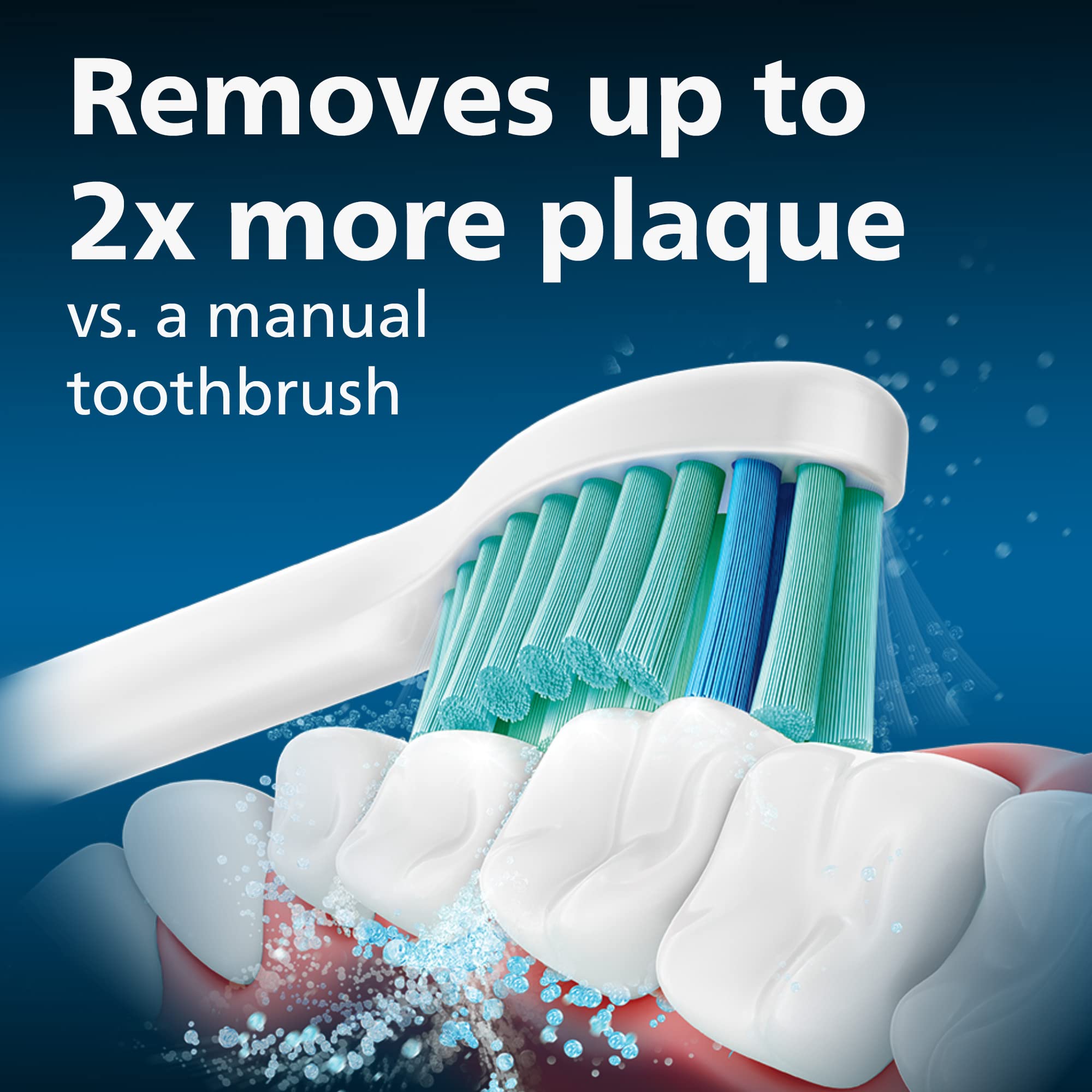 Philips Sonicare e-Series contoured bristles enhance cleaning between teeth.