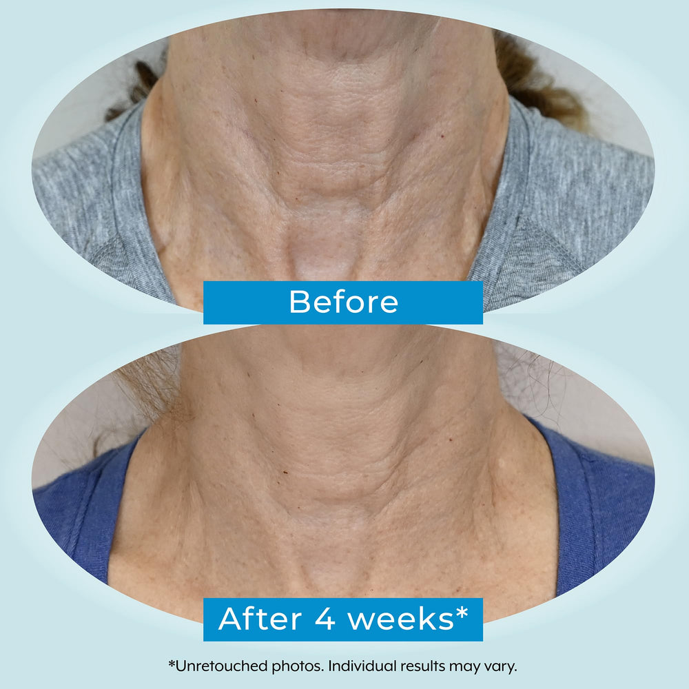Bakuchiol icon with Plexaderm label highlighting gentle support.