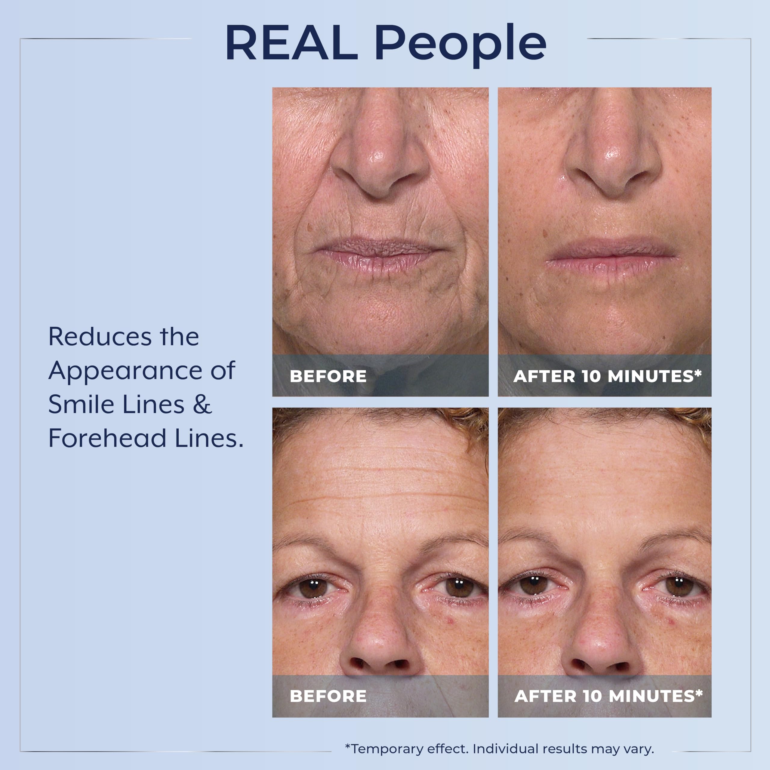 Plexaderm serum drying to a ten-minute finish on clean skin.
