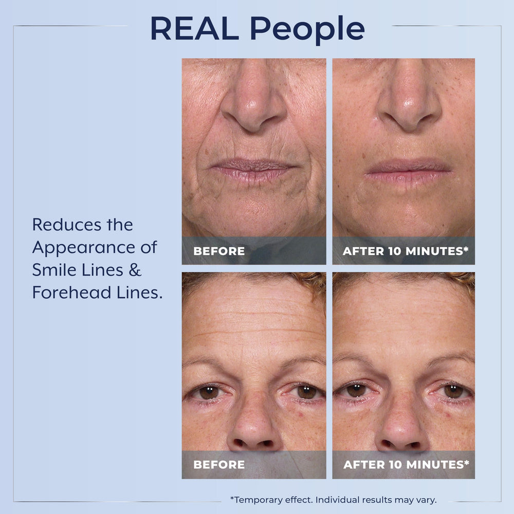 Plexaderm serum drying to a ten-minute finish on clean skin.