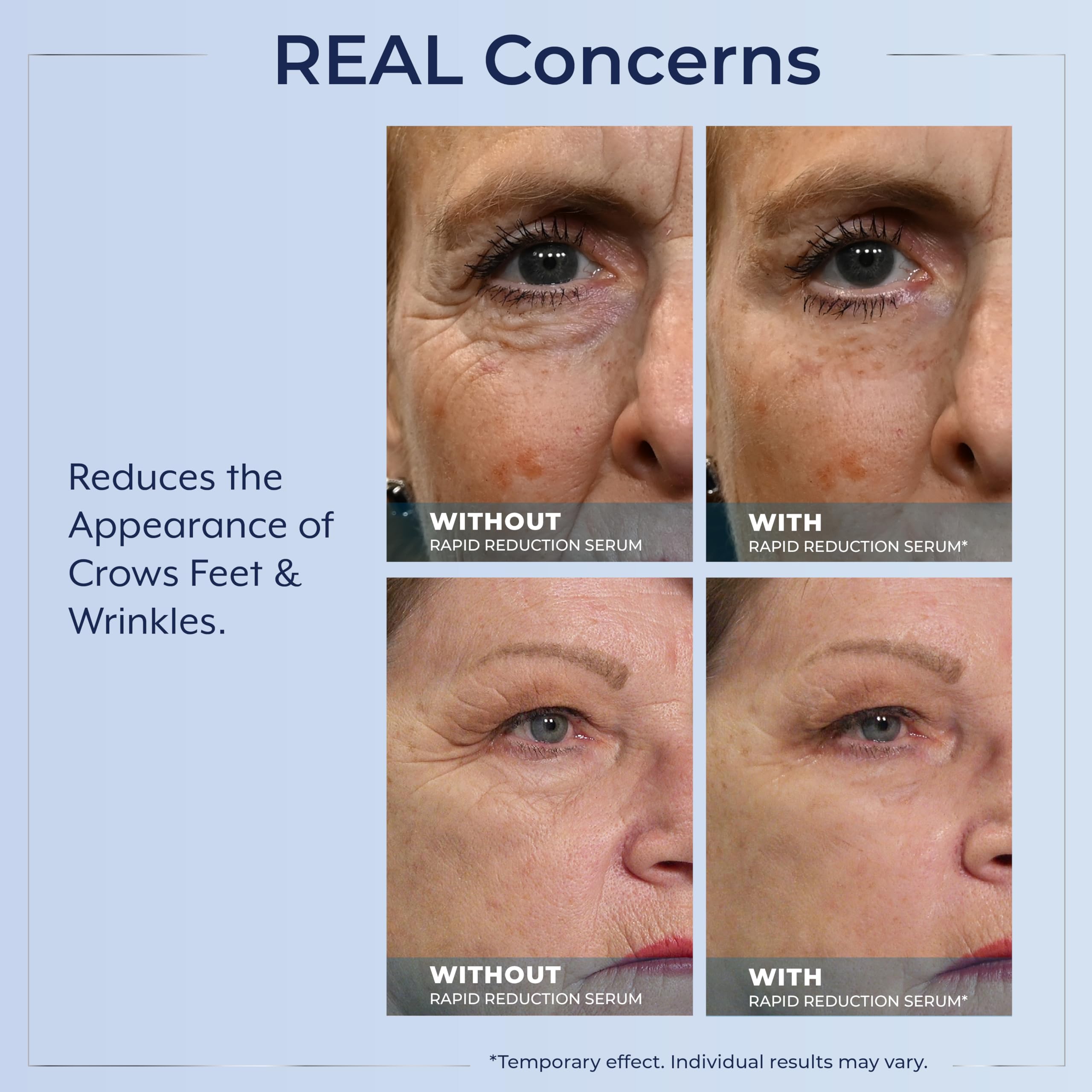 Close-up of Plexaderm serum on the face with a satin finish.