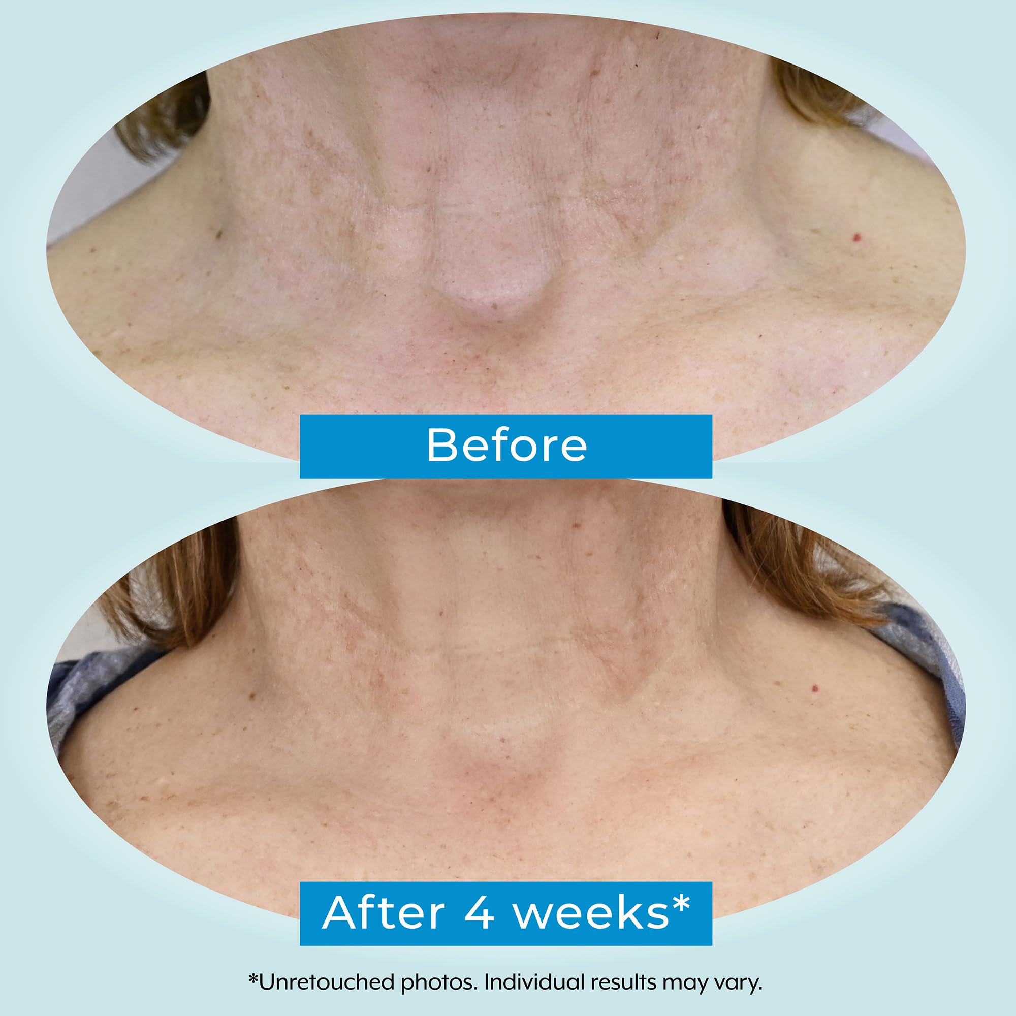 Graphic of Plexaderm 1% retinol and 2% bakuchiol powering the formula.