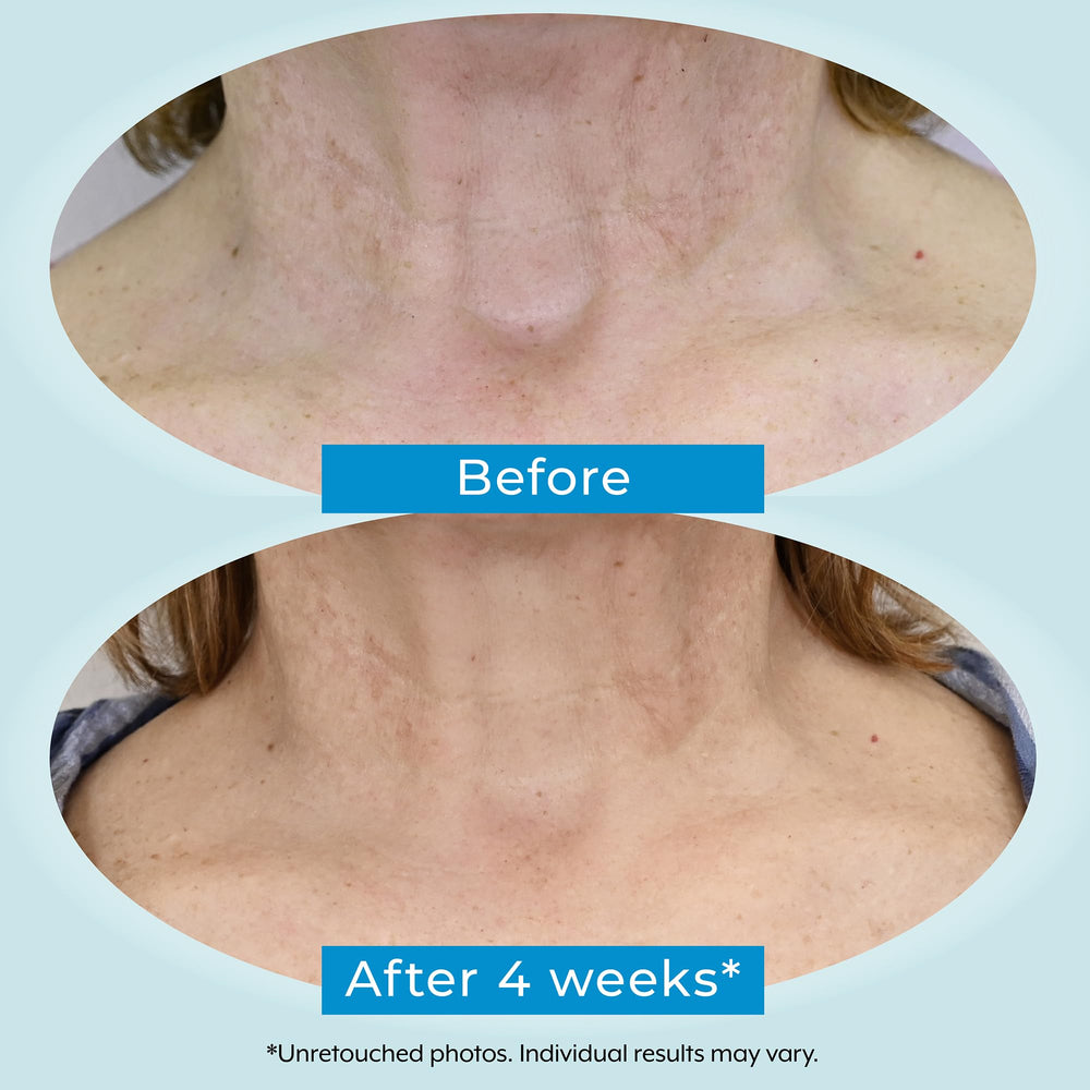 Graphic of Plexaderm 1% retinol and 2% bakuchiol powering the formula.