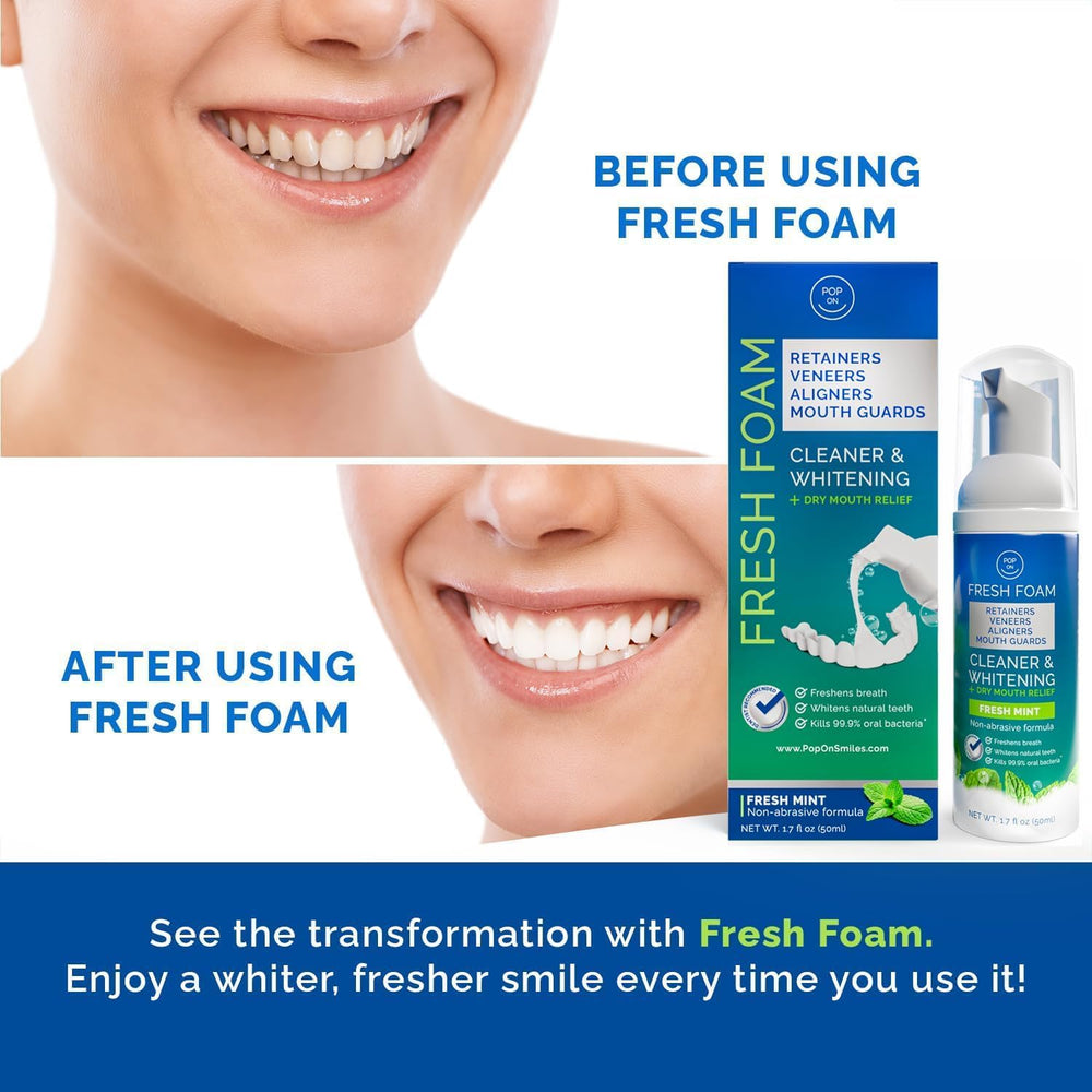 POP ON VENEERS mouthguard cleaning with the foam for easy maintenance.