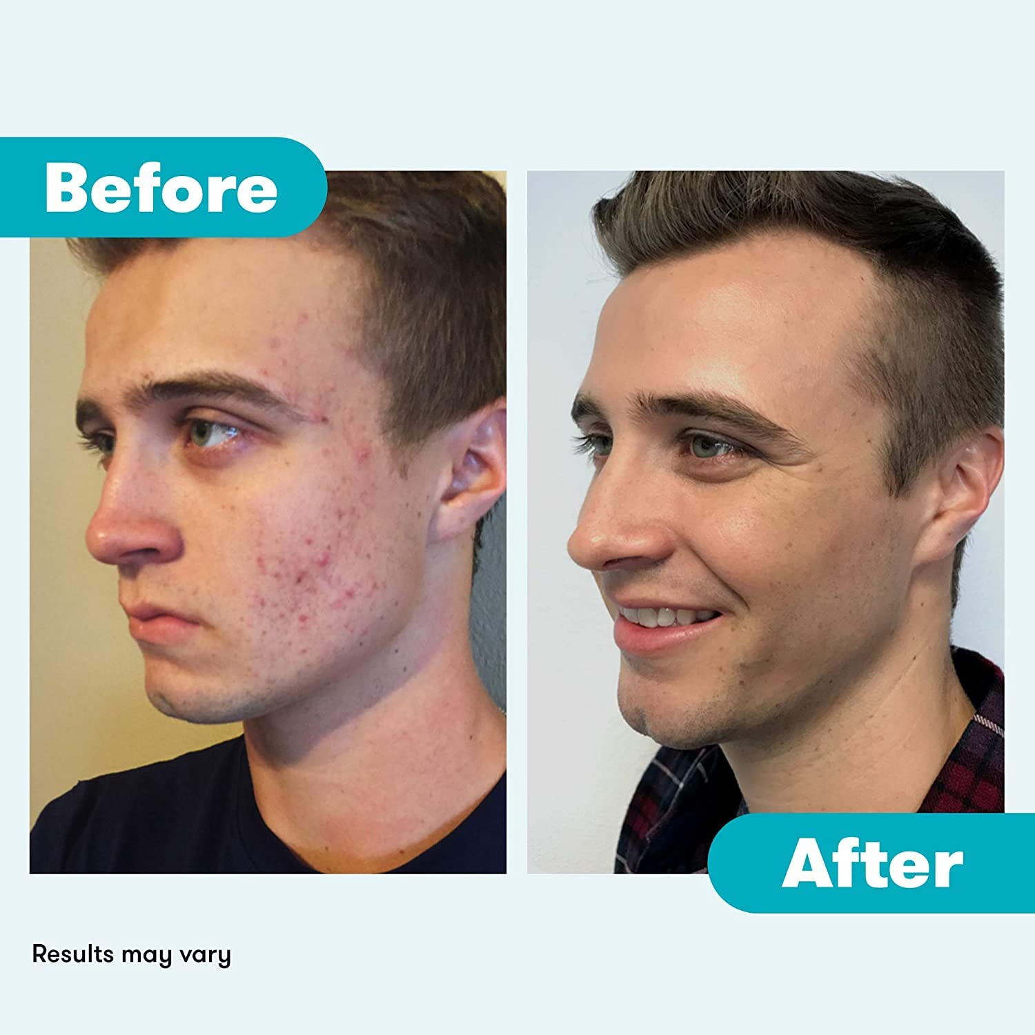 90-day supply box for ongoing Proactiv skincare routine