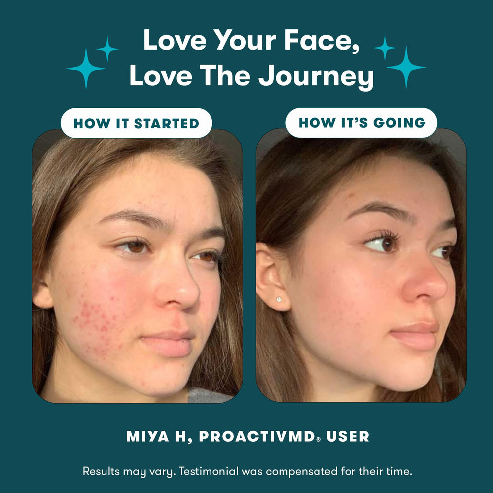 Proactiv MD 30-day acne treatment kit box showing complete routine.