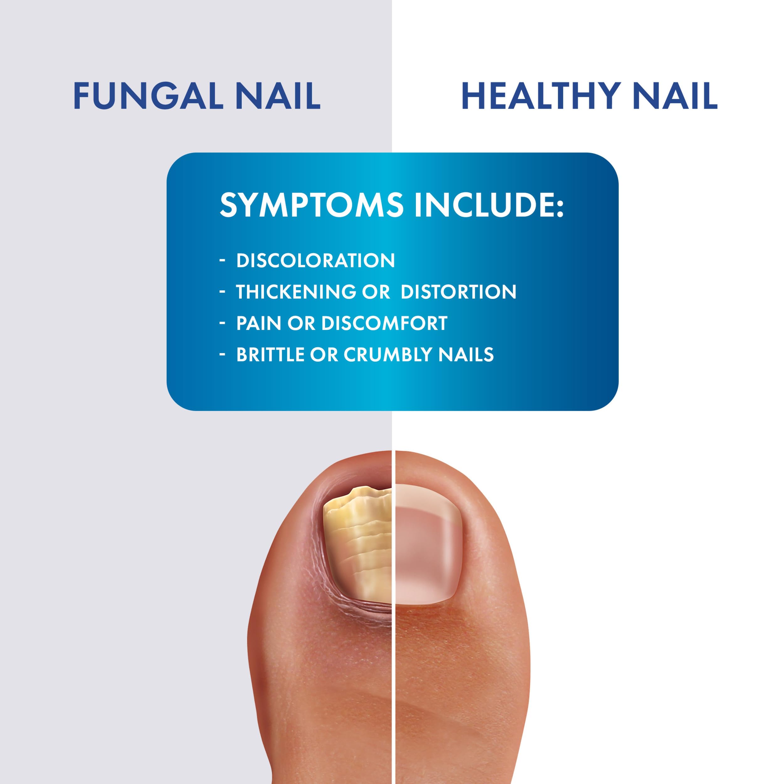 Clear, fast-drying formula from ProClearz Fungal Shield for comfortable skin.