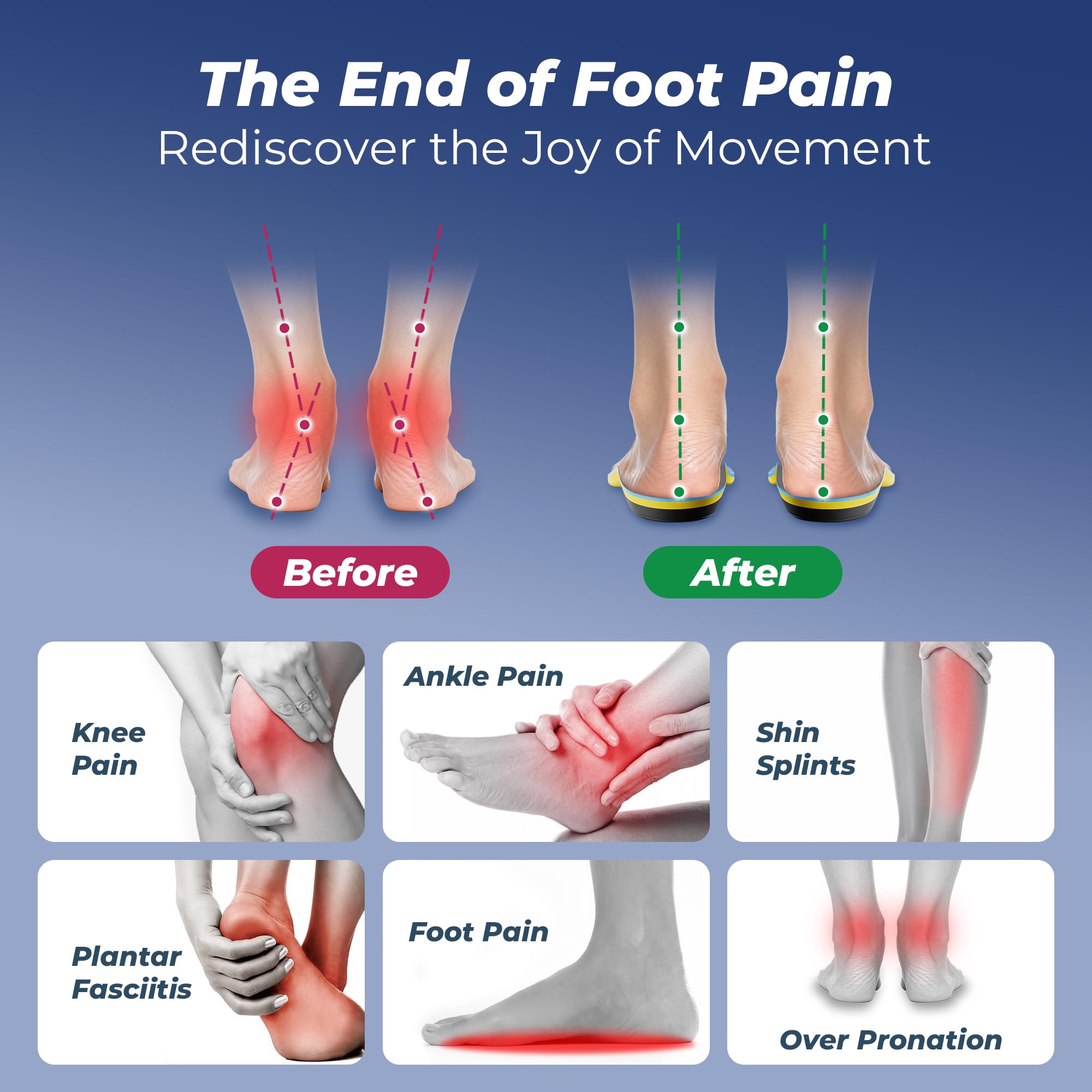 Psveb golden triangle arch-support insoles relieve arch pressure during long walks.