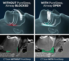 PureSleep universal fit design adapts to most jaw shapes