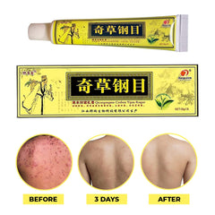 QICAOGANGMU Chinese Herbal Cream texture close-up shows rich herbal blend for soothing skin.